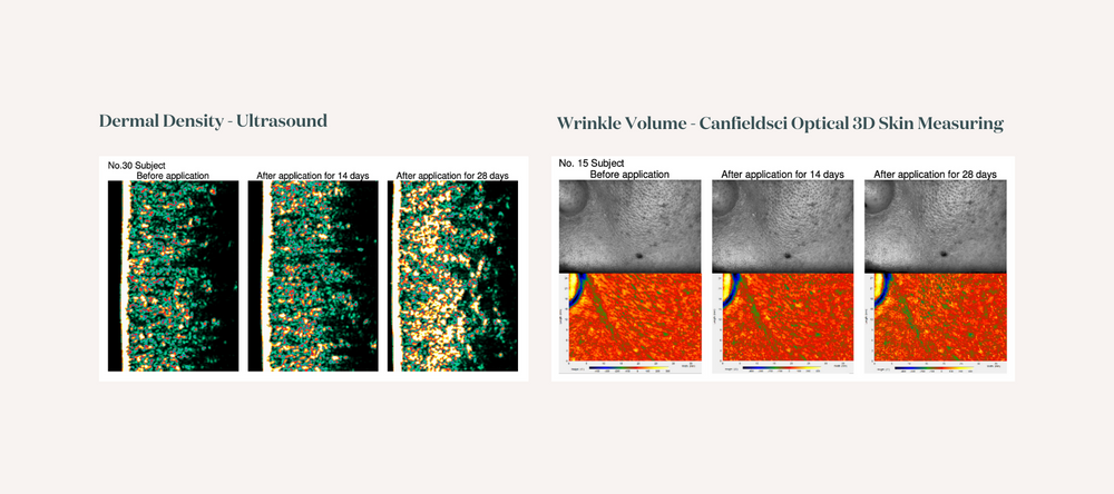 Ultrasound and 3D skin measuring scans showing the changes in dermal density and wrinkle reduction over time during the study