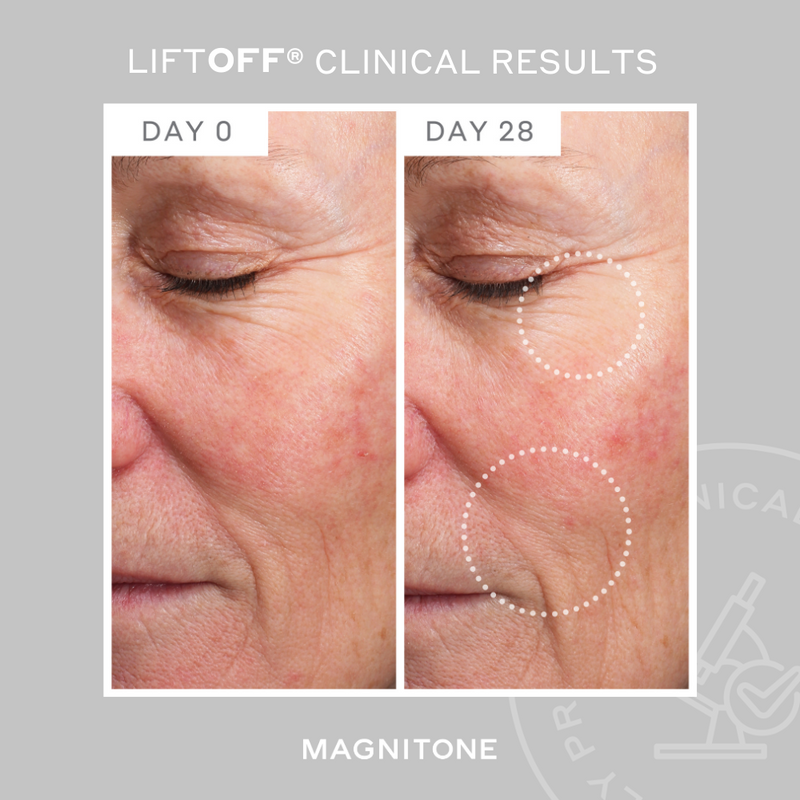MAGNITONE LiftOff Clinical Results showing before and after of wrinkle reduction around the eye area and marionette lines after 28 days