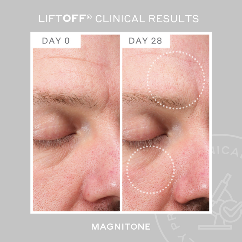 MAGNITONE LiftOff Clinical Results showing before and after of wrinkle reduction around the eye area and forehead after 28 days