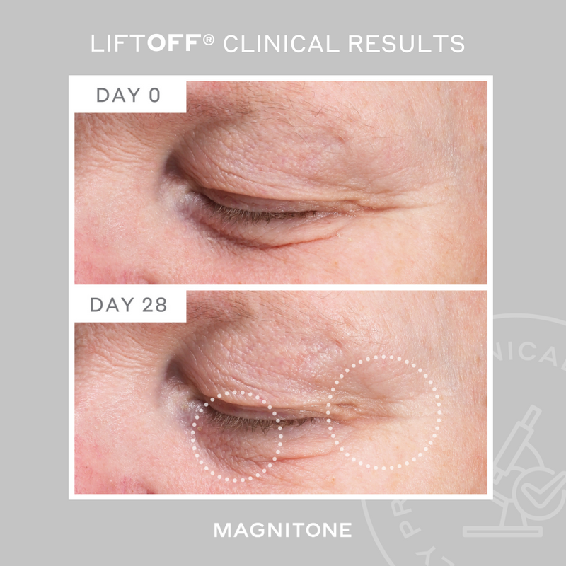 MAGNITONE LiftOff Clinical Results showing before and after of wrinkle reduction around the eye area after 28 days