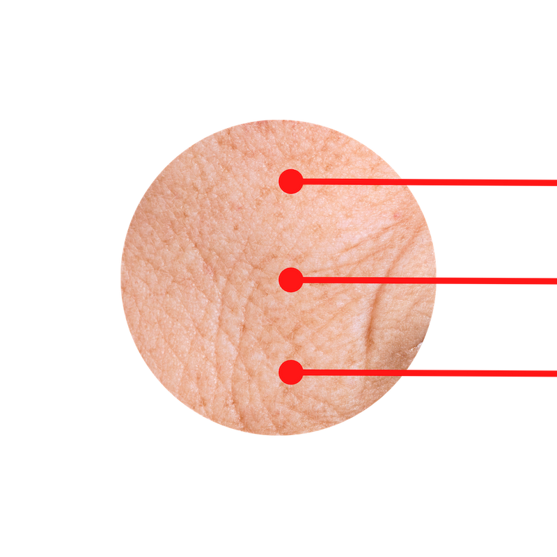 Red LED Light Beams on wrinkled skin