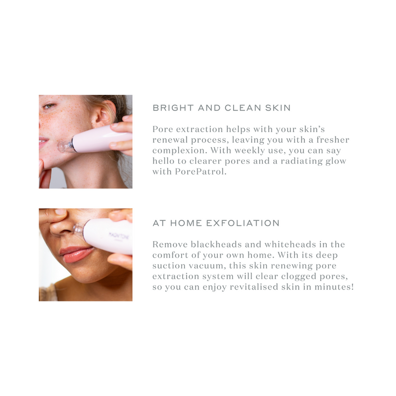 Pore Patrol® Skin Renewing Pore Extraction System