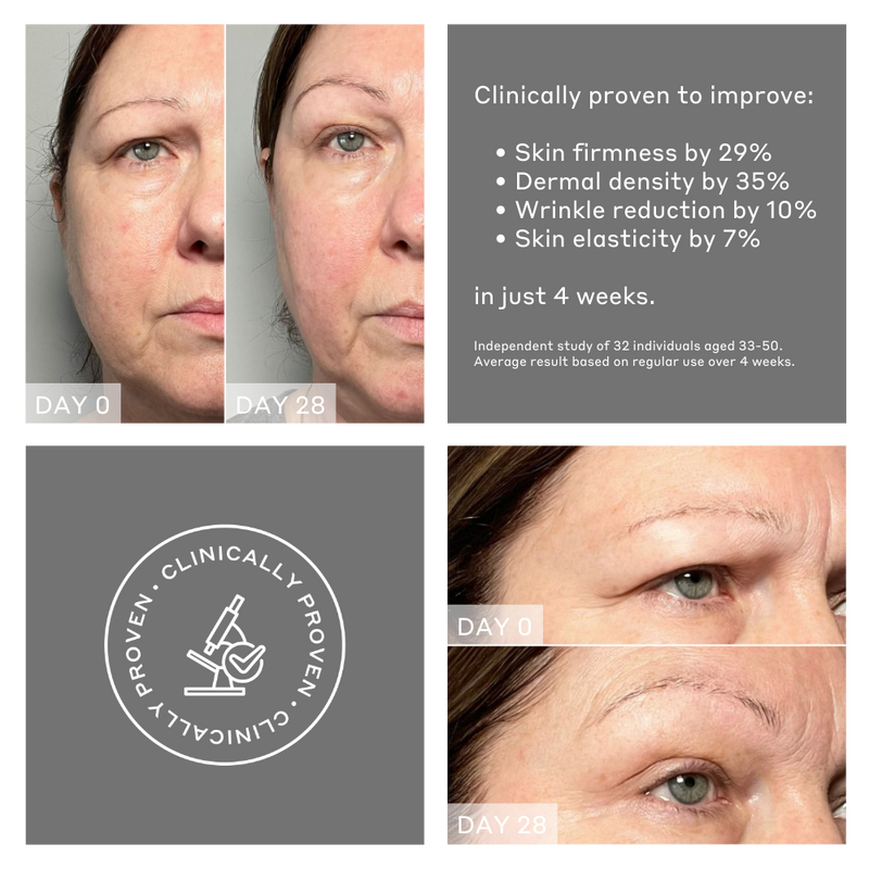 Before and after pictures showing results on MAGNITONE FaceRocket 5-in-1 Facial Firming + Toning Device | after 28 days subject's brow is significantly lifted, skin is smoother and more sculpted. The device is clinically proven to improve skin firmness by 29%, dermal density by 35%, wrinkle reduction by 10% and skin elasticity by 7% after 4 weeks