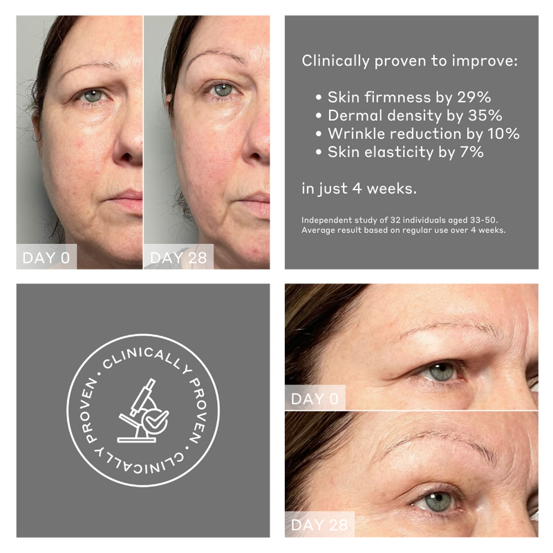 Before and after pictures showing results on MAGNITONE FaceRocket 5-in-1 Facial Firming + Toning Device | after 28 days subject's brow is significantly lifted, skin is smoother and more sculpted. The device is clinically proven to improve skin firmness by 29%, dermal density by 35%, wrinkle reduction by 10% and skin elasticity by 7% after 4 weeks 