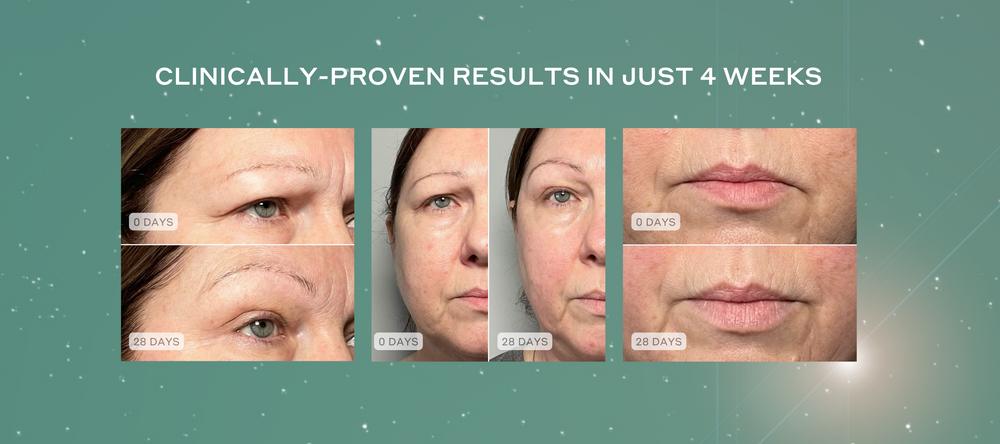 Clinically proven results in 4 weeks. Before and after pictures showing face is lifted and toned after 28 days, brow is significantly lifted and lips are more plumped