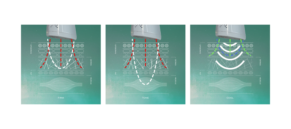 Technical drawings of the skin, showing how the technologies penetrate each layer of the skin. Firm mode targets the Dermis, Tone mode targets the facial muscles, Cool mode targets the Epidermis