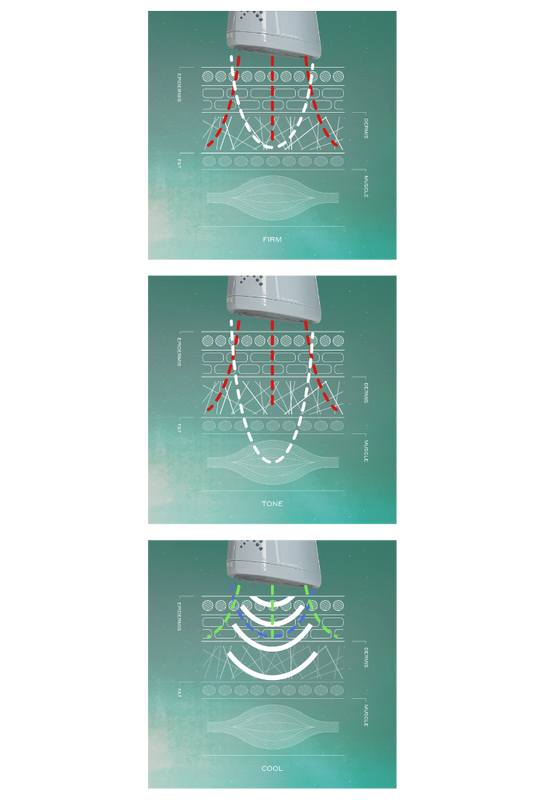 Technical drawings of the skin, showing how the technologies penetrate each layer of the skin. Firm mode targets the Dermis, Tone mode targets the facial muscles, Cool mode targets the Epidermis