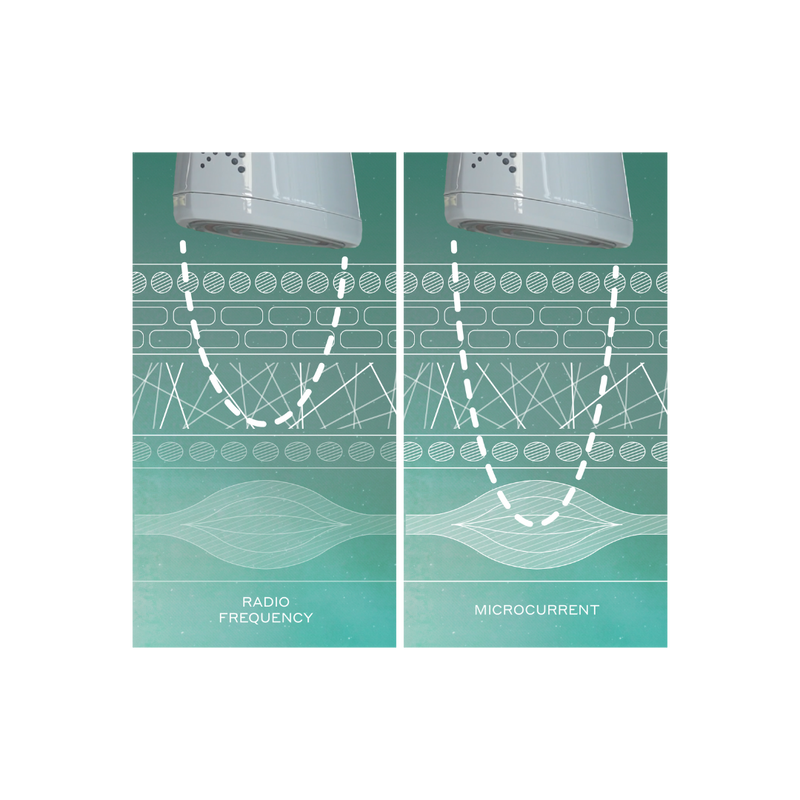 Illustration of skin diagram showing radio waves reaching the dermis and microcurrent reaching facial muscle