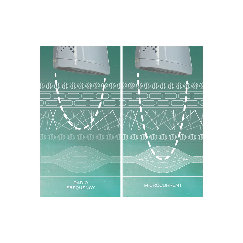 Radiofrequency 101 | MAGNITONE London