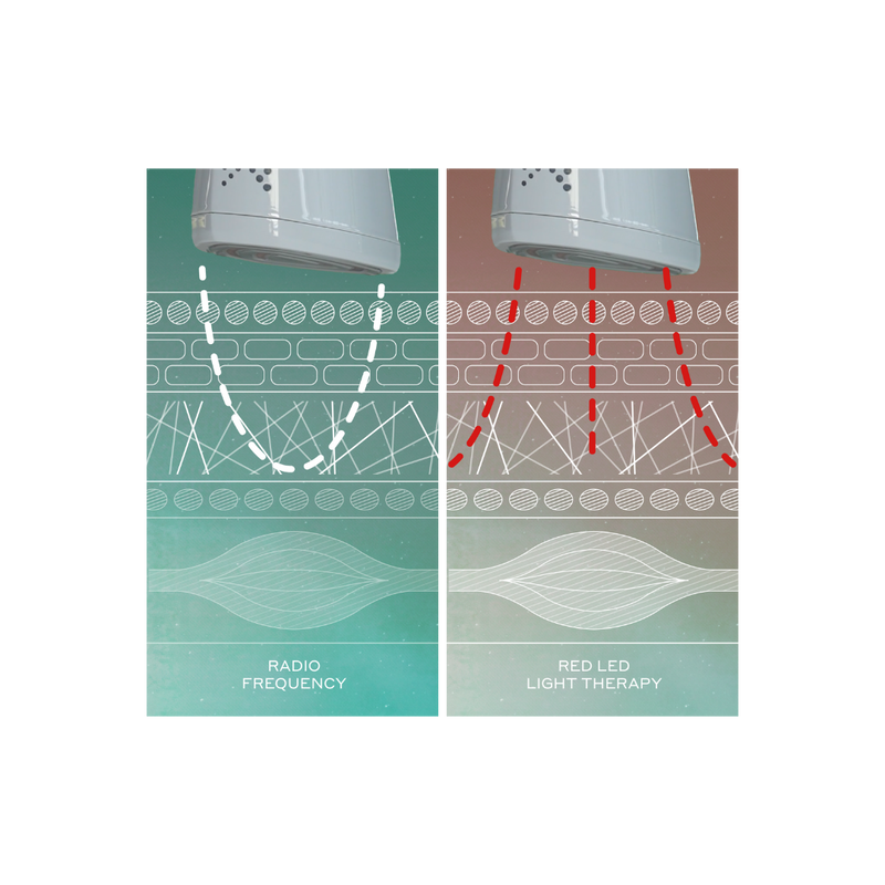 Illustration of skin diagram showing radio waves reaching the dermis and red LED light reaching the dermis