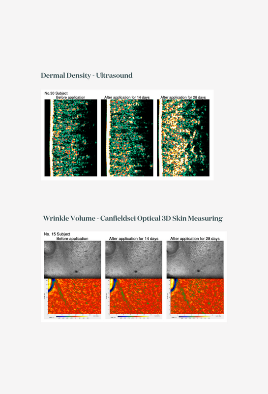 Ultrasound and 3D skin measuring scans showing the changes in dermal density and wrinkle reduction over time during the study
