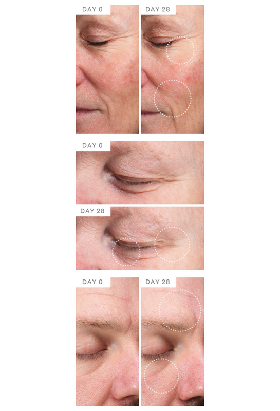 MAGNITONE LiftOff Microcurrent Facial Toning Device | Clinical Study